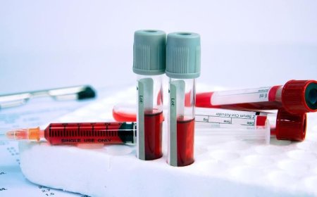 VIVER COM A FALCIFORME EM SILÊNCIO: FAMÍLIAS SEM TRATAMENTO PREOCUPAM POPULAÇÃO