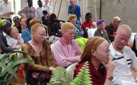 PRECONCEITO AFASTA ALBINOS DA CONVIVÊNCIA SOCIAL