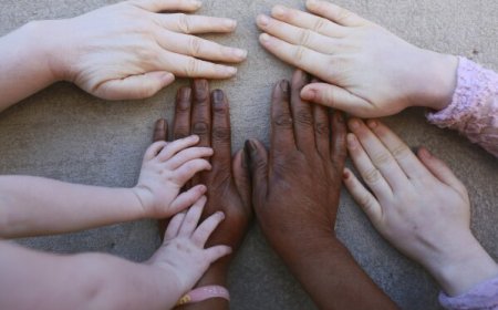 MITO OU VERDADE: ALBINOS MORREM OU DESPARECEM?