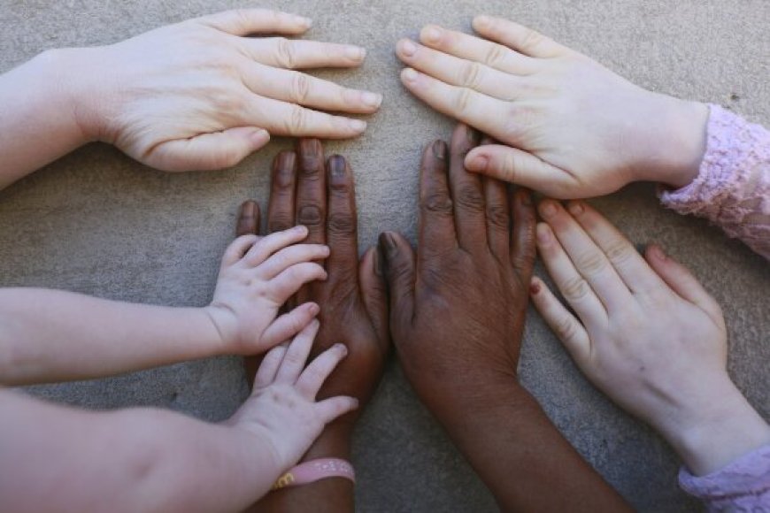 MITO OU VERDADE: ALBINOS MORREM OU DESPARECEM?