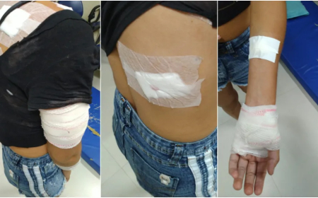 CIDADÃ ESFAQUEADA MAIS DE DEZ VEZES PELO EX-MARIDO