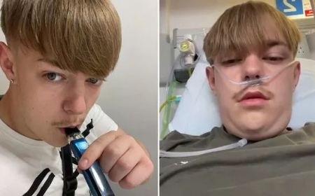JOVEM QUE USAVA VAPE DESDE OS 12 ANOS FICA ASSOMBRADO APÓS TOSSIR SANGUE