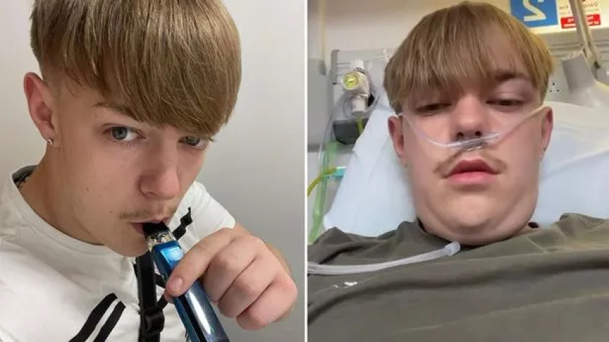 JOVEM QUE USAVA VAPE DESDE OS 12 ANOS FICA ASSOMBRADO APÓS TOSSIR SANGUE