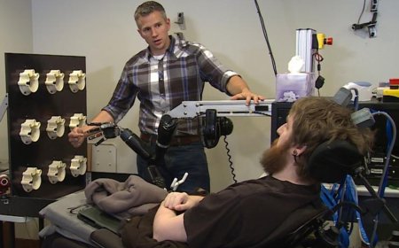 IMPLANTE CEREBRAL PERMITE QUE  TETRAPLÉGICO SINTA OBJECTOS USANDO MÃOS DE OUTRAS PESSOAS