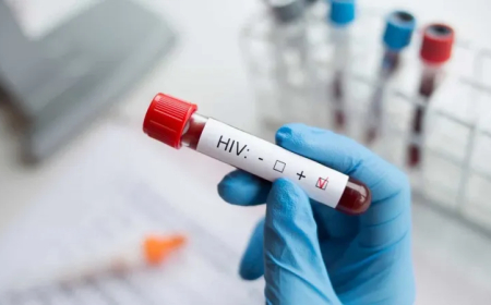 DIA MUNDIAL DE LUTA CONTRA A SIDA: ESTIMAM-SE 320 MIL PESSOAS A VIVER COM VIH EM ANGOLA