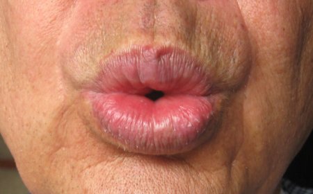 ENTRE O ASSOBIO E A VERGONHA: O NOVO NORMAL DÁ O SEU SHOW