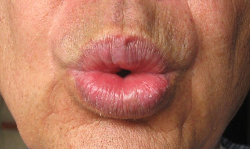 ENTRE O ASSOBIO E A VERGONHA: O NOVO NORMAL DÁ O SEU SHOW