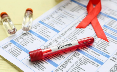 DIA MUNDIAL DE LUTA CONTRA A SIDA: ESTIMAM-SE 320 MIL PESSOAS A VIVER COM VIH EM ANGOLA