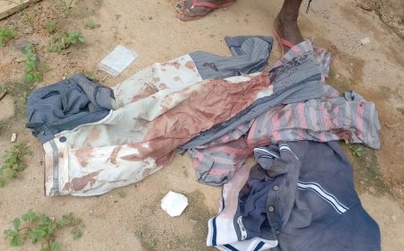 CIDADÃO GRAVEMENTE FERIDO EM ASSALTO COM ARMA BRANCA NO BAIRRO DA PAZ