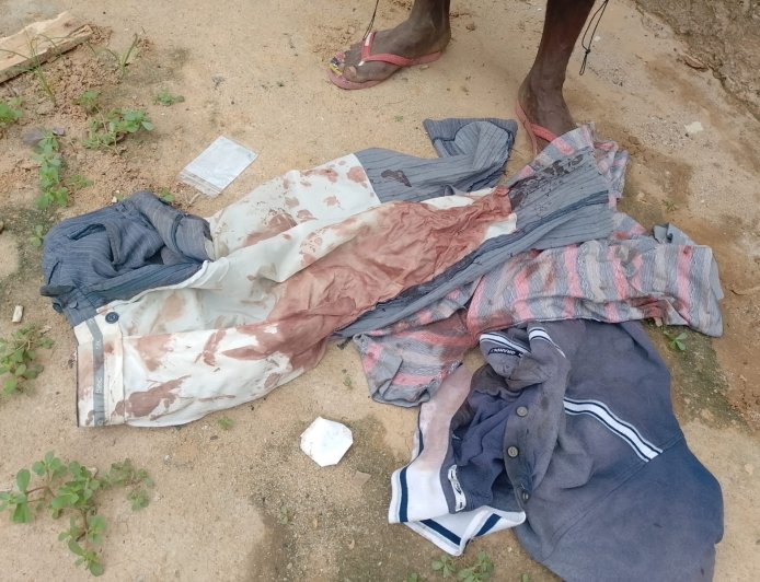 CIDADÃO GRAVEMENTE FERIDO EM ASSALTO COM ARMA BRANCA NO BAIRRO DA PAZ