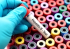 HEPATITE B AFECTA 21% DA POPULAÇÃO EM ANGOLA E TORNA-SE PRIORIDADE MÁXIMA PARA AS AUTORIDADES