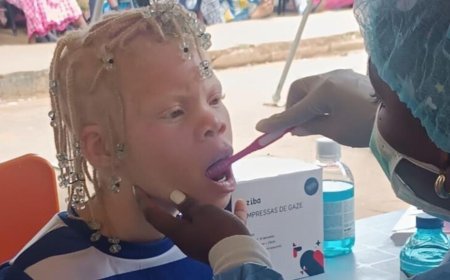 CAMPANHA REFORÇA ASSISTÊNCIA MÉDICA E INCLUSÃO DE PESSOAS COM ALBINISMO NO QUÉSSUA