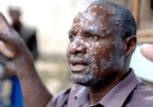 CABINDA RECEBE MAIS 30 MIL DOSES DE VACINAS PARA REFORÇAR COMBATE À MPOX