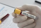 FAMILIARES COLABORAM NA RECOLHA DE AMOSTRAS PARA TESTES DE DNA EM MALANJE