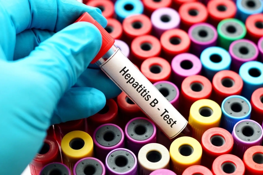 HEPATITE B AFECTA 21% DA POPULAÇÃO EM ANGOLA E TORNA-SE PRIORIDADE MÁXIMA PARA AS AUTORIDADES